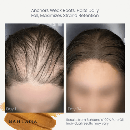 Customer before and after: reduced daily hair fall, day 1 vs day 34
