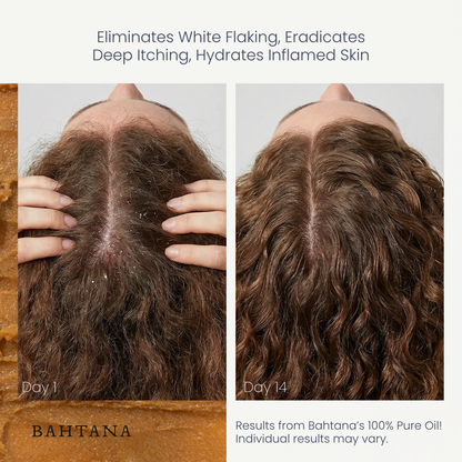 Customer before and after: hydrated scalp with less flaking, day 1 vs day 14